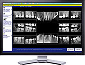 Digital Dental X-ray Technology at Clinton Family Dental